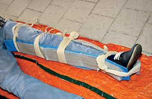 Оказание первой помощи Наложение шины при переломе