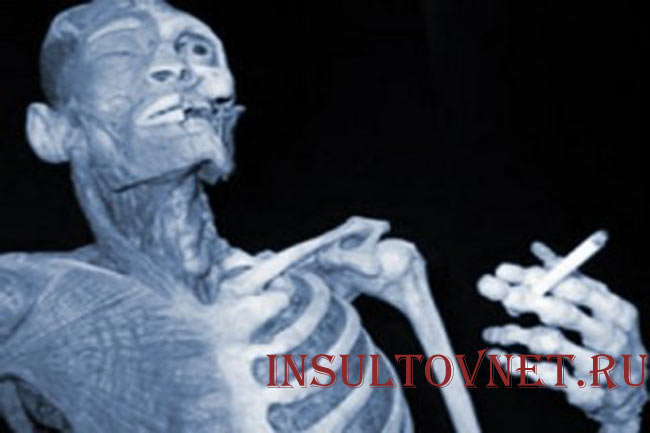 Курение инсульт