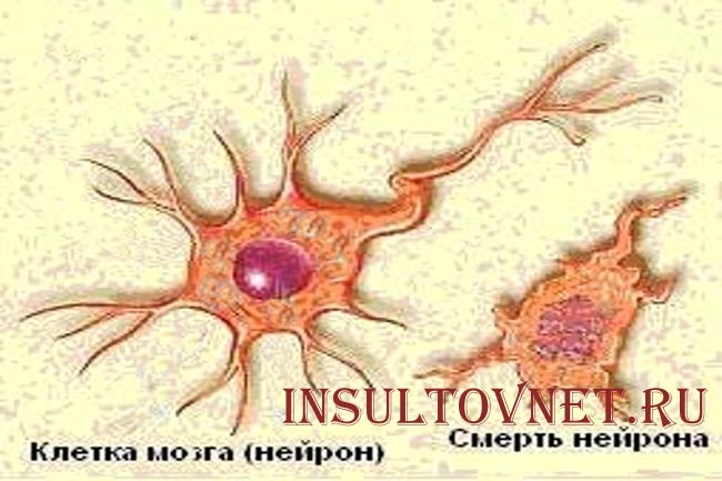Гибель нейронов головного мозга