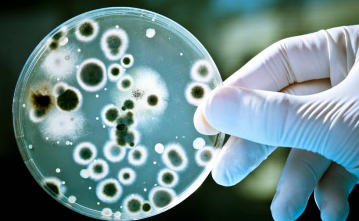 Микробиологический метод