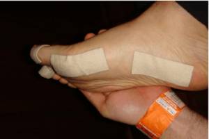 Магнитный пластырь Hyperosteogeny от гиперостоза