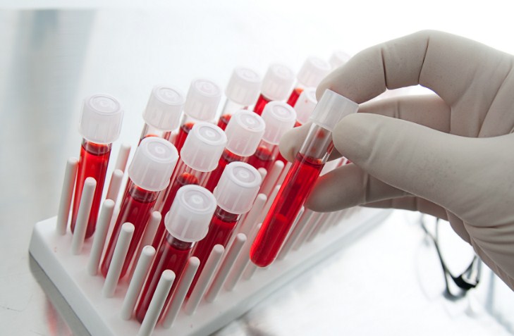 анализ крови