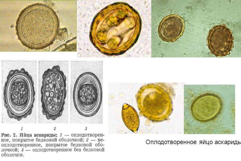 яйца аскарид на разных стадиях
