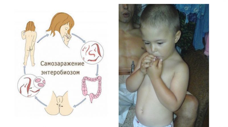 способ заражения