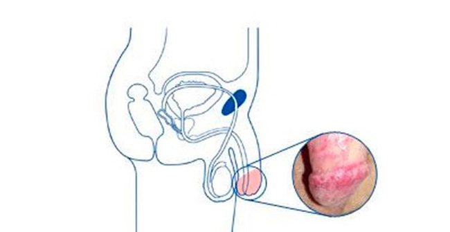 симптомы возникновения