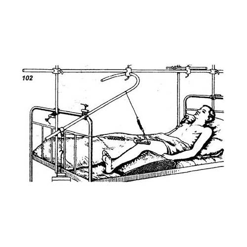 Вытяжение Скелетное вытяжение при переломе шейки бедра