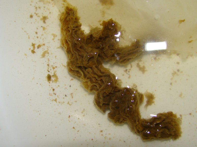 глисты у детей