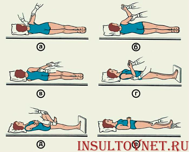 Упражнения после инсульта