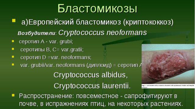 бластомикозы