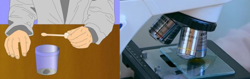 Как сдавать анализ кала