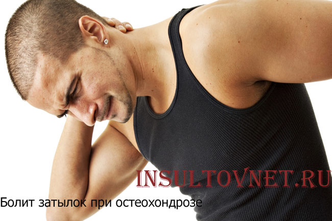 Болит затылок при остеохондрозе
