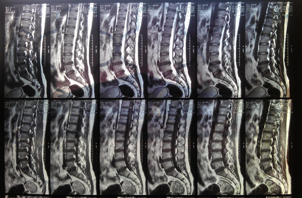 снимки МРТ Качество снимков МРТ позволяют с точностью определить любое заболевание