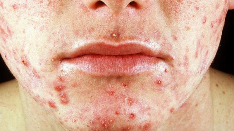 поражение кожного покрова