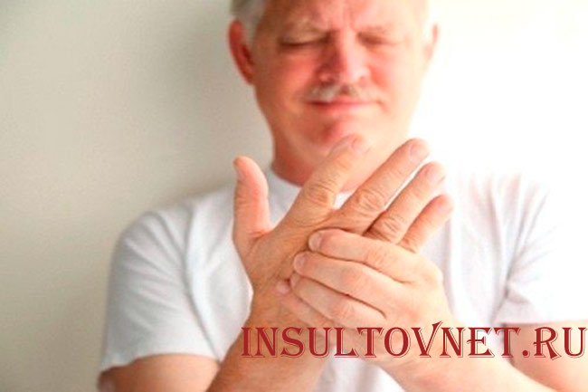 Сильное онемение