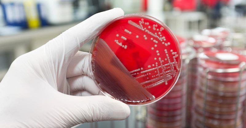 анализ на Стафилококк