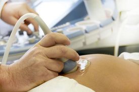 узи во время беременности для диагностики