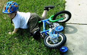 Падение с велосипеда Падение на руку