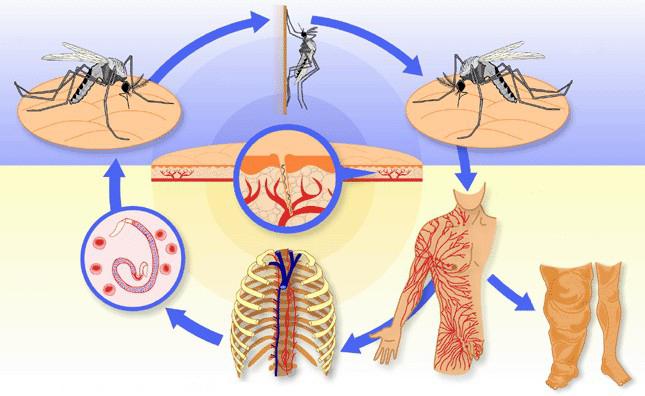 Что такое филяриоз