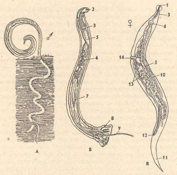 Острицы Острицы