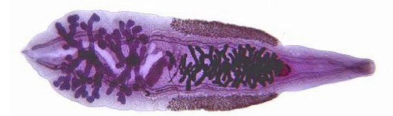Описторхия