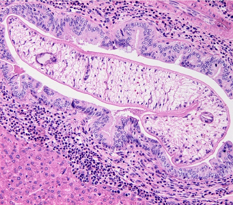 Opisthorchis felineus