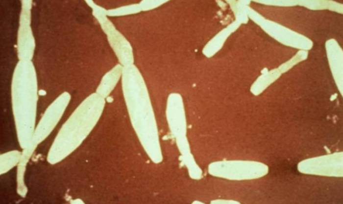 Эхинококкоз