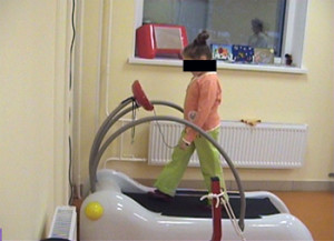 Лечебная физкультура Болезнь Легга-Кальве-Пертеса