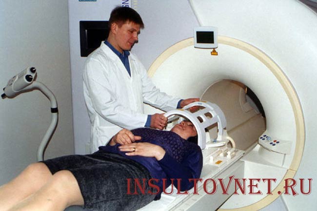 Опухоль мозга