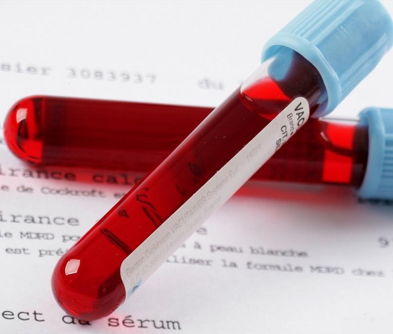 Анализ крови наличие антител igg к токсоплазм