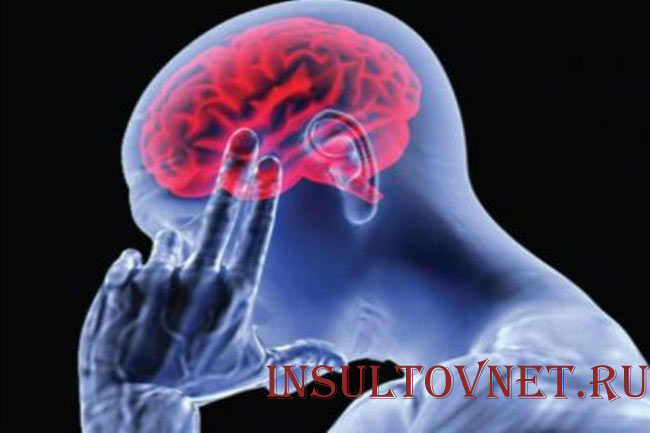 Нарушение кровообращения мозга