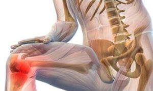 Эффективность геля при боли в суставах