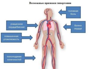 Гипертония признаки и симптомы