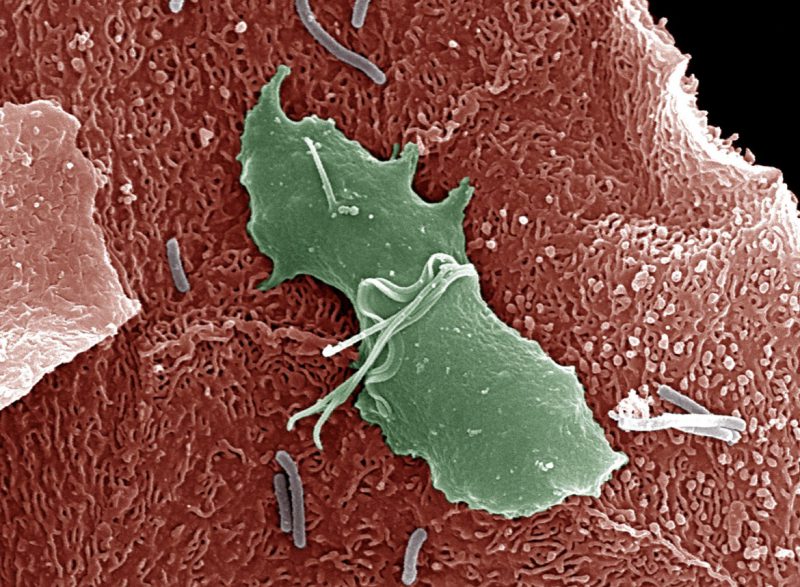 трихомонада