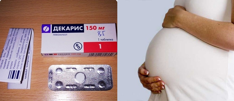 Декарис на поздних сроках