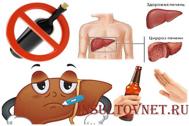Алкоголь и цирроз печени
