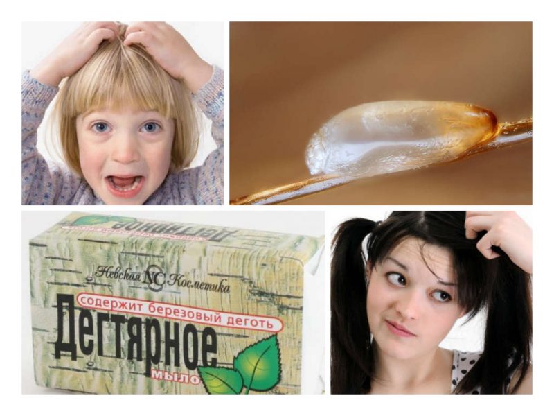 заражение вшами