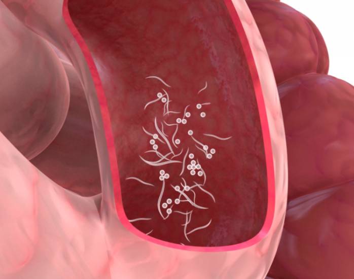 гельминты в жкт