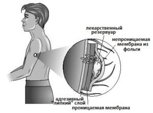 Механизм действия никотинового пластыря
