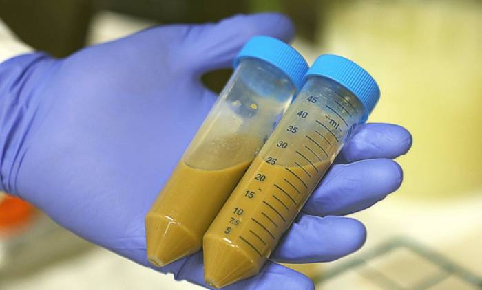 анализ кала