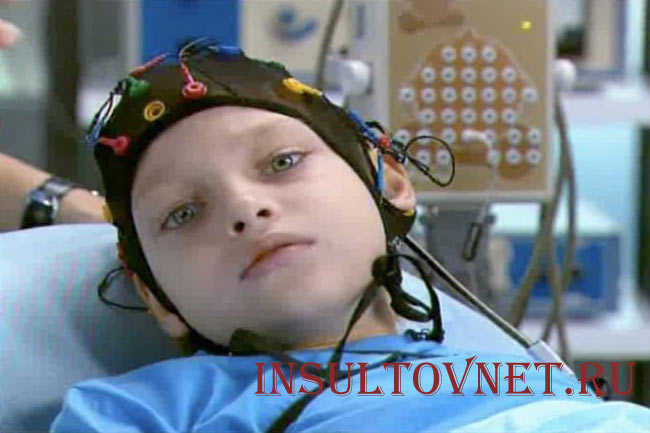 Абсанс после травмы головы