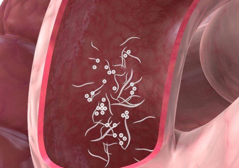 как определить