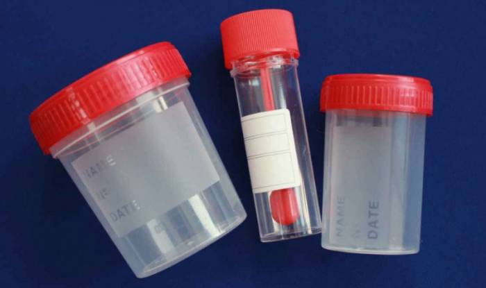 баночка для кала