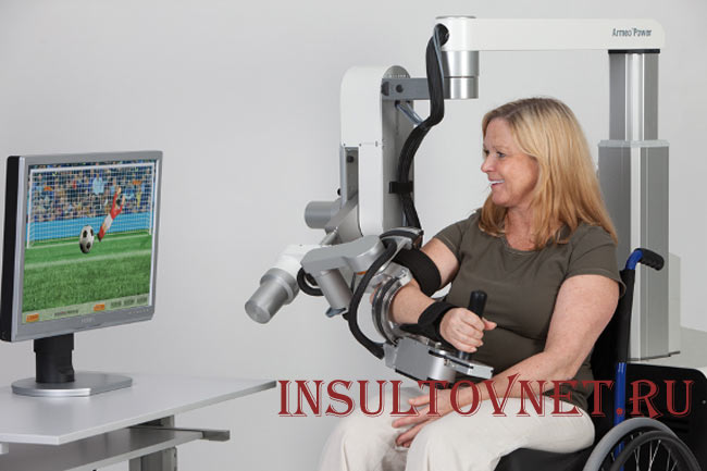 Реабилитация движений руки