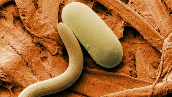 энтеробиоз