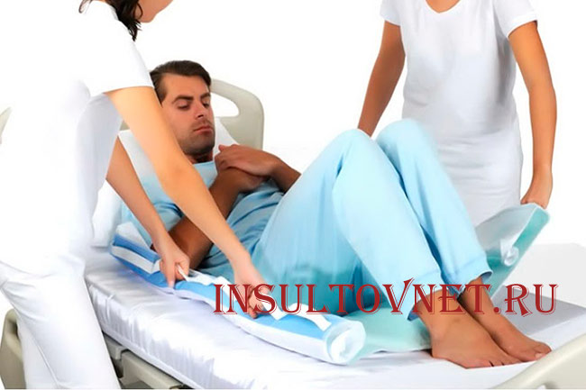 Профилактика пролежней