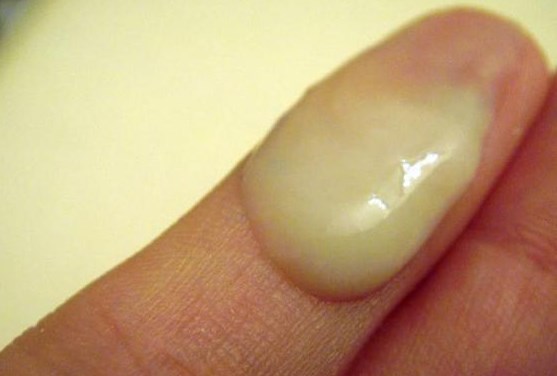 Первичная симптоматика