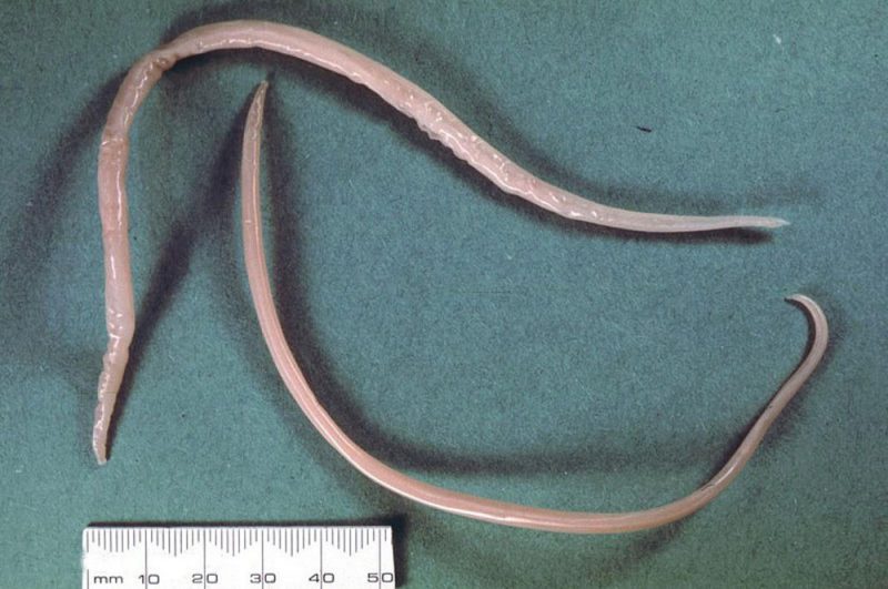 аскариды у человека