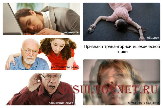 Признаки ТИА
