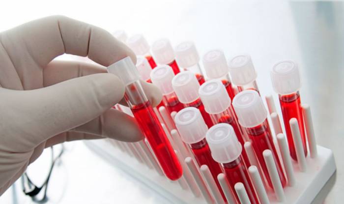 анализ крови