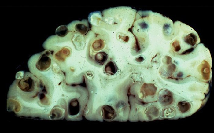 Неглерия Фоулера